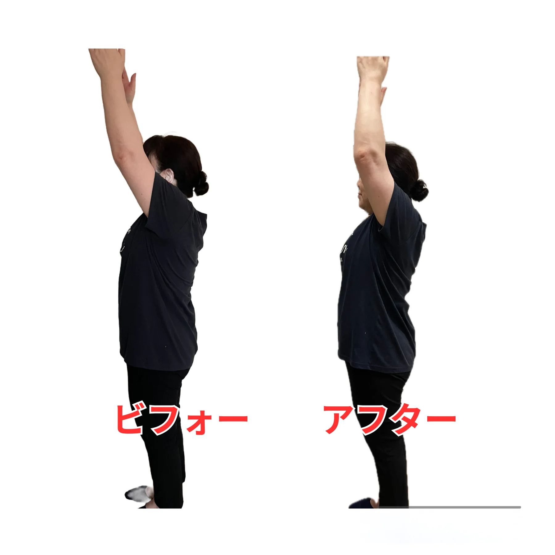 肩まわりの動きのビフォーアフター参考写真