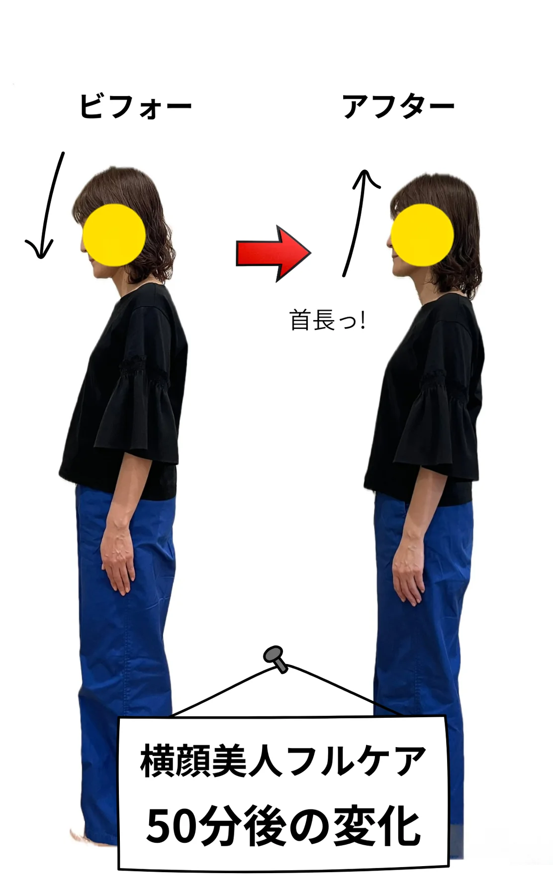 横顔美人フルケアのビフォーアフター参考写真